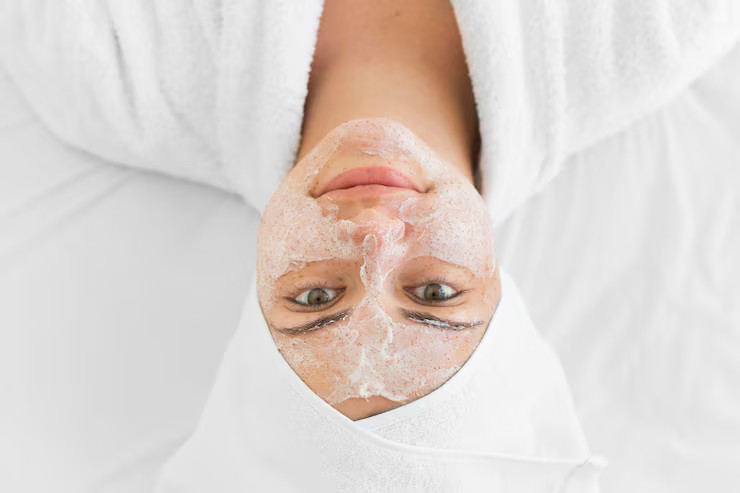 Peeling Químico